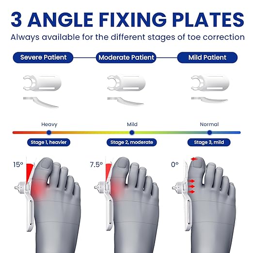 Bunion Corrector for Women & Men, Big Toe Straightener with 3 Different Angle Fixing Plate, Orthopedic Bunion Splint for Hallux Valgus, Hammer Toe Corrector & Bunion Brace for Bunion Relief (1 packing)