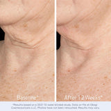 Obagi ELASTIDERM® NECK AND DÉCOLLETÉ CONCENTRATE  – 2 oz