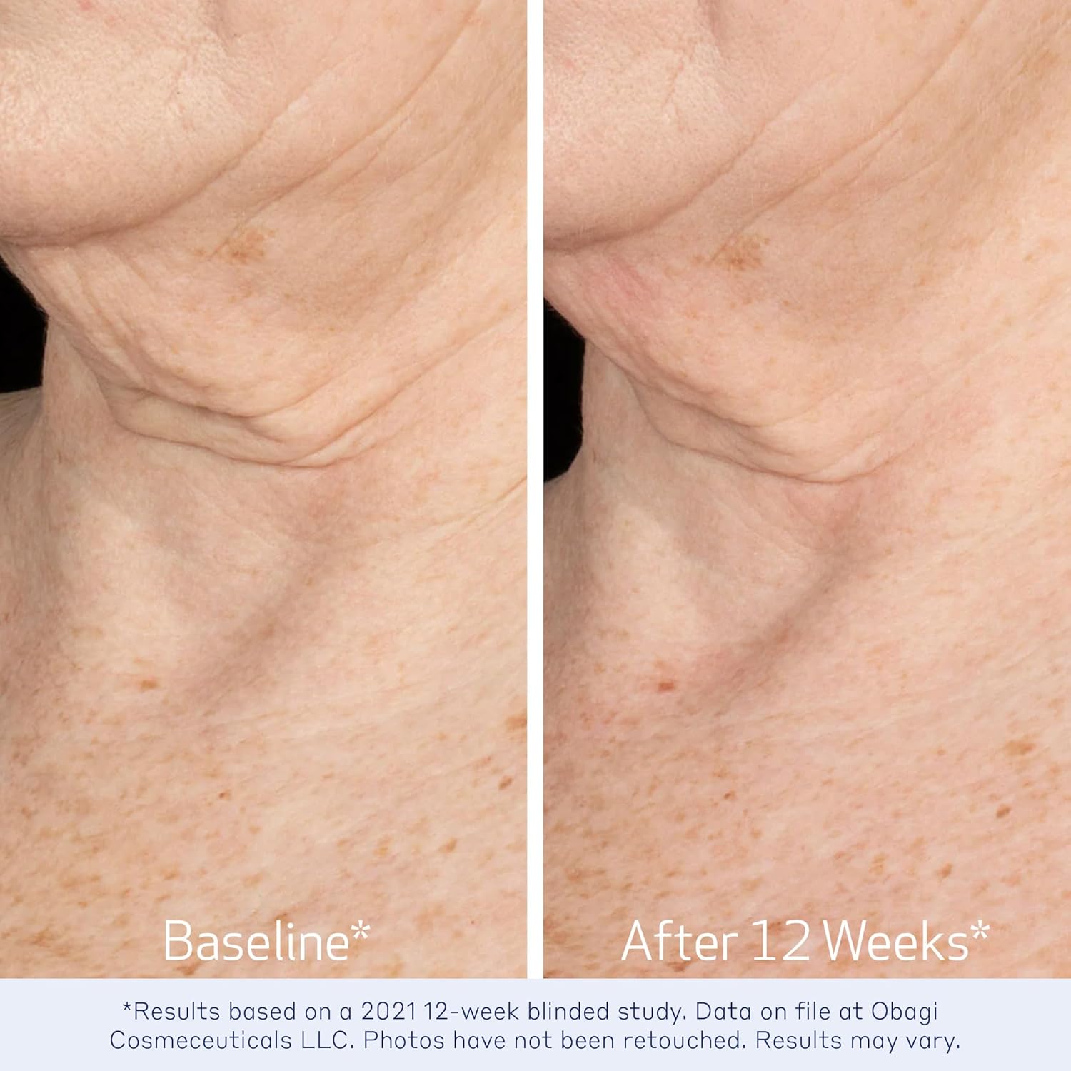 Obagi ELASTIDERM® NECK AND DÉCOLLETÉ CONCENTRATE  – 2 oz