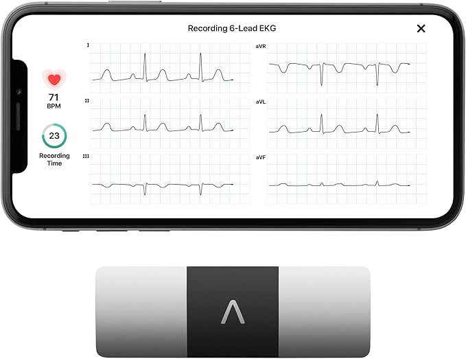 Kardia 6L | Personal 6 Lead EKG