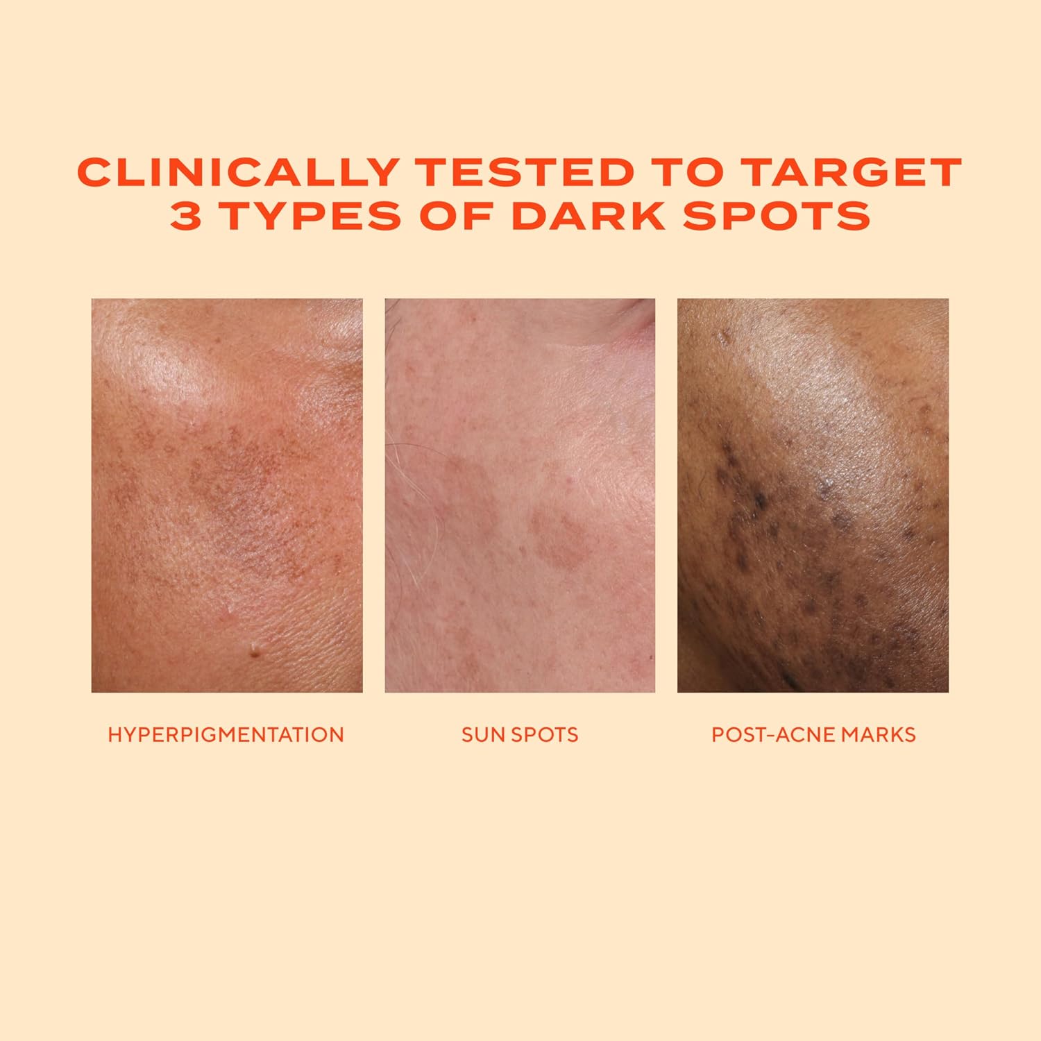 Murad Rapid Dark Spot Correcting Serum - Glycolic Acid - 1 Fl Oz