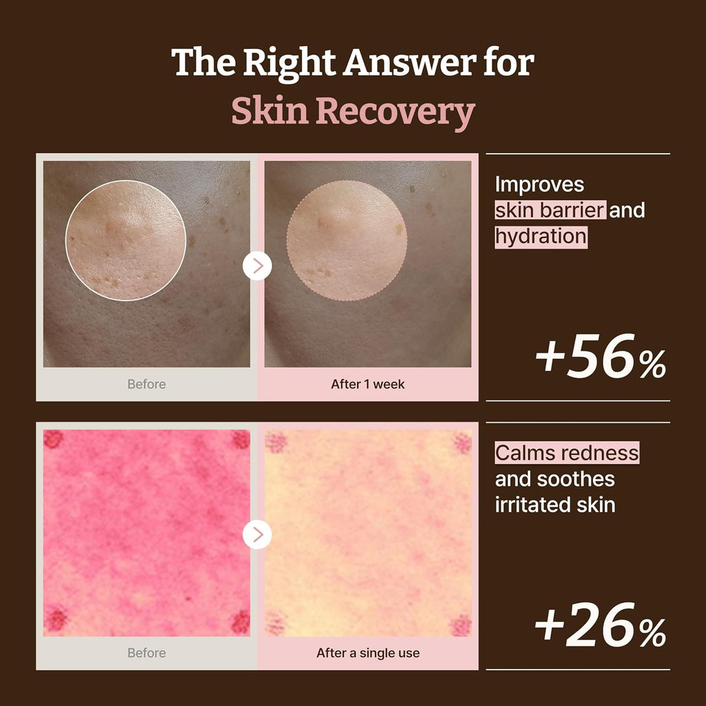 DR. REJU-ALL | Advanced PDRN Rejuvenating Cream for Face | 0.68 fl oz