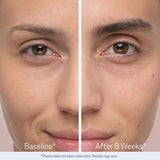 Obagi  Nu-Cil Eyebrow Boosting Serum 5 ML