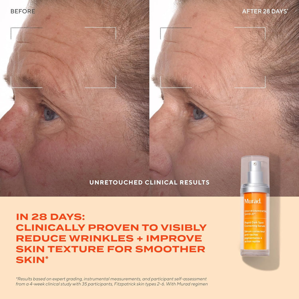 Murad Rapid Dark Spot Correcting Serum - Glycolic Acid - 1 Fl Oz