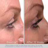 Obagi Nu-Cil Eyelash Enhancing Serum - 3 ML