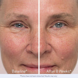 Obagi  Nu-Cil Eyebrow Boosting Serum 5 ML