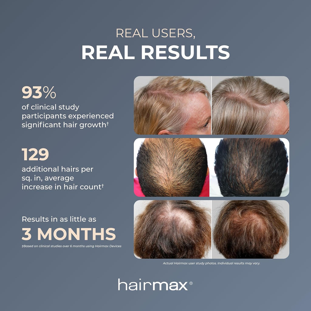 Hairmax Ultima 9 Classic LaserComb, FDA Cleared Red Light For Hair Regrowth