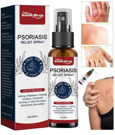 South Moon Psoriasis Relief Spray - 30 ml