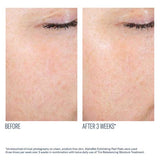 SkinBetter Science AlphaRet Exfoliating Peel Pads - 10 Pack