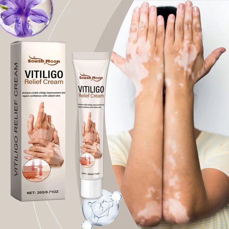 South Moon Vitiligo Relief Cream - 0.71 oz.
