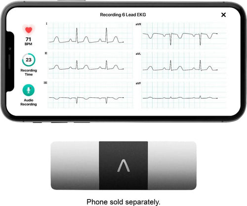 AliveCor - KardiaMobile 6L Personal EKG Monitor - Black